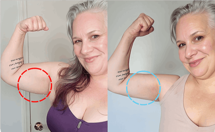 My Derma Dream Red Light Therapy customer review Anabelle